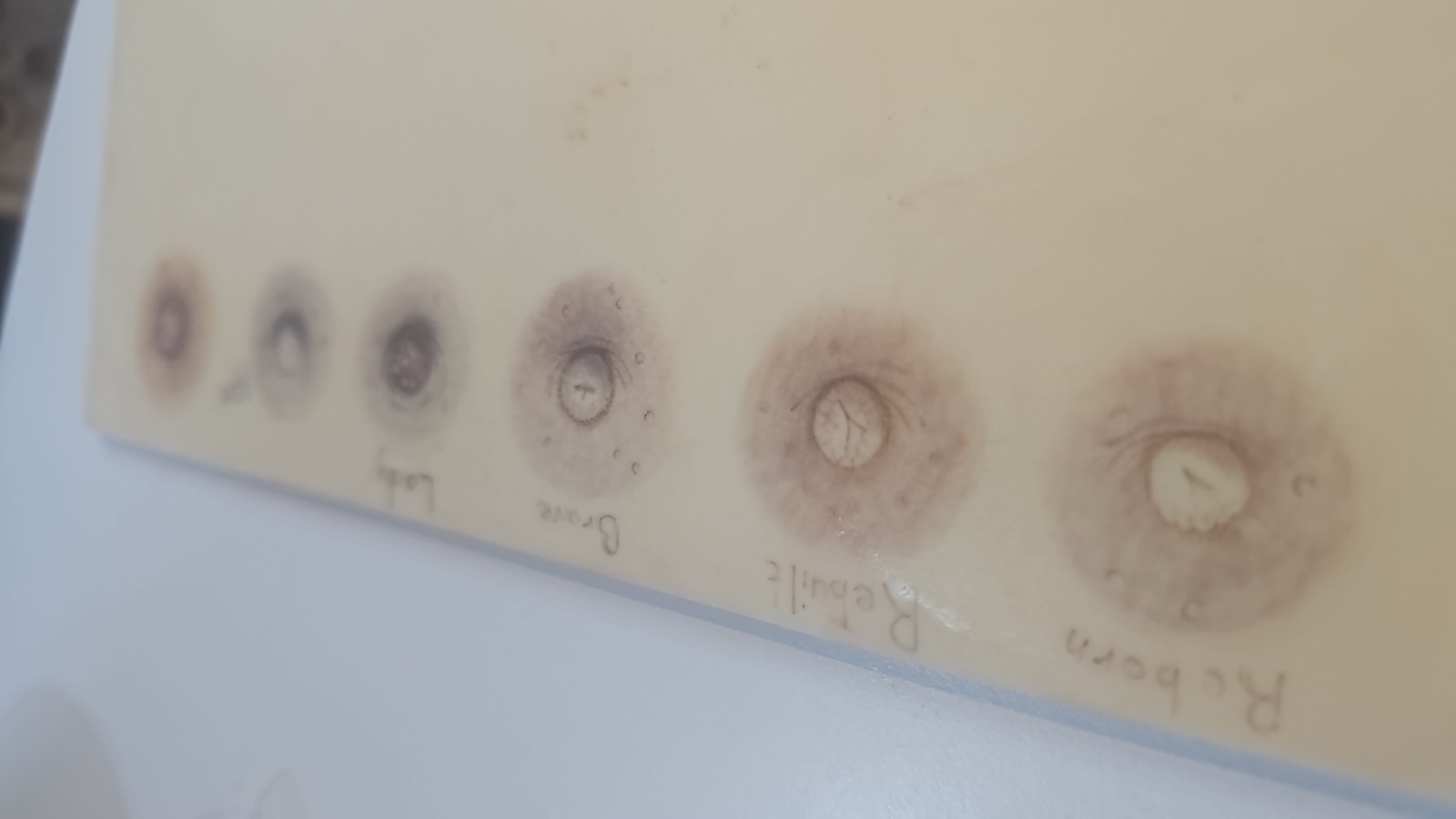 Evolución de la técnica de reconstrucción
